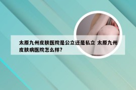 太原九州皮肤医院是公立还是私立 太原九州皮肤病医院怎么样?