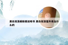 黑白双清癣除根说明书 黑白双清是外用治什么的