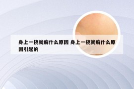 身上一挠就癣什么原因 身上一挠就癣什么原因引起的