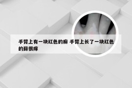 手臂上有一块红色的癣 手臂上长了一块红色的藓很痒