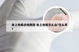 身上有癣点啥原因 身上有癣怎么治?怎么弄?