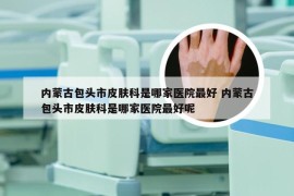 内蒙古包头市皮肤科是哪家医院最好 内蒙古包头市皮肤科是哪家医院最好呢