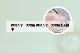 脚背长了一大块癣 脚背长了一大块癣怎么回事