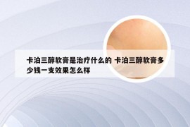 卡泊三醇软膏是治疗什么的 卡泊三醇软膏多少钱一支效果怎么样