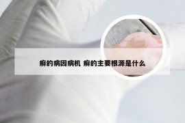 癣的病因病机 癣的主要根源是什么