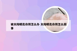 被太阳晒出白斑怎么办 太阳晒出白斑怎么回事