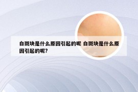 白斑块是什么原因引起的呢 白斑块是什么原因引起的呢?