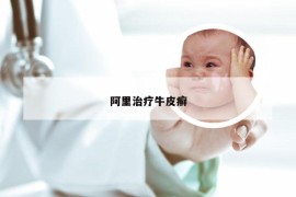 阿里治疗牛皮癣