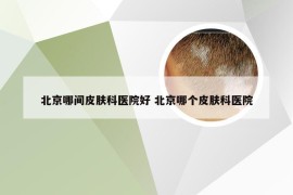 北京哪间皮肤科医院好 北京哪个皮肤科医院