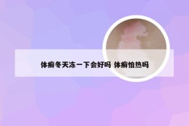 体癣冬天冻一下会好吗 体癣怕热吗
