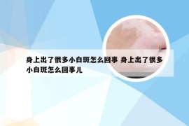 身上出了很多小白斑怎么回事 身上出了很多小白斑怎么回事儿