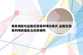 银屑病能吃盐酸左西替利嗪分散片 盐酸左西替利嗪胶囊能治皮肤病吗