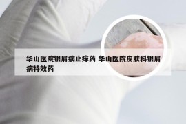 华山医院银屑病止痒药 华山医院皮肤科银屑病特效药