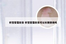 积雪苷霜软膏 积雪苷霜软膏可以长期使用吗
