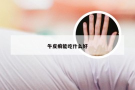 牛皮癣能吃什么好