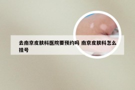 去南京皮肤科医院要预约吗 南京皮肤科怎么挂号