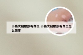 小孩大腿根部有白斑 小孩大腿根部有白斑怎么回事