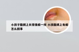 小孩子胳膊上长得像癣一样 小孩胳膊上有癣怎么回事