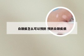 白颠疯怎么可以预防 预防白颠疯病