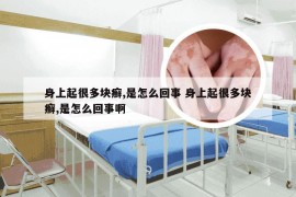 身上起很多块癣,是怎么回事 身上起很多块癣,是怎么回事啊