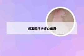 哪家医院治疗白癜风