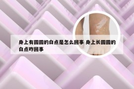 身上有圆圆的白点是怎么回事 身上长圆圆的白点咋回事