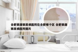 合肥银康银屑病医院在合肥哪个区 合肥银康银屑病医院图片