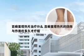 百癣夏塔热片治疗什么 百癣夏塔热片的功效与作用吃多久才疗程