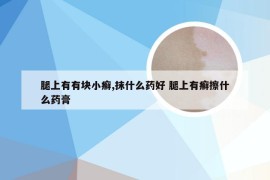 腿上有有块小癣,抹什么药好 腿上有癣擦什么药膏