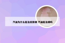 汽油为什么能治皮肤病 汽油能治病吗