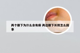 两个腋下为什么会有癣 两边腋下长斑怎么回事