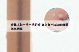 身体上长一块一块的癣 身上有一块块的癣是怎么回事