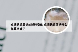 点滴状银屑病的好转变化 点滴状银屑病什么样算治好了