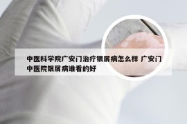 中医科学院广安门治疗银屑病怎么样 广安门中医院银屑病谁看的好
