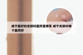 咸宁最好的皮肤科医院是哪家 咸宁皮肤科哪个医院好