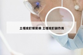 土槿皮酊银屑病 土槿皮酊副作用