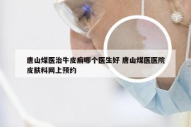 唐山煤医治牛皮癣哪个医生好 唐山煤医医院皮肤科网上预约