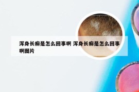 浑身长癣是怎么回事啊 浑身长癣是怎么回事啊图片