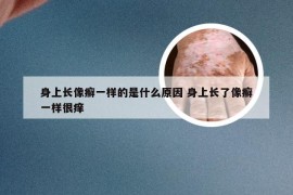 身上长像癣一样的是什么原因 身上长了像癣一样很痒