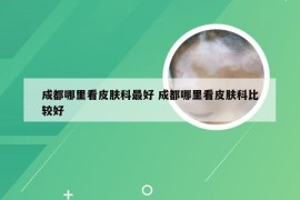 成都哪里看皮肤科最好 成都哪里看皮肤科比较好