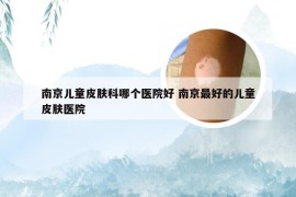 南京儿童皮肤科哪个医院好 南京最好的儿童皮肤医院