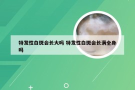 特发性白斑会长大吗 特发性白斑会长满全身吗