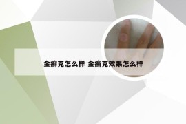 金癣克怎么样 金癣克效果怎么样