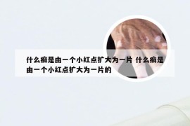 什么癣是由一个小红点扩大为一片 什么癣是由一个小红点扩大为一片的