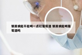银屑病能不能喝一点红葡萄酒 银屑病能喝葡萄酒吗
