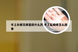 手上长癣又痒是搽什么药 手上起癣痒怎么回事