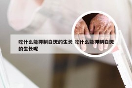 吃什么能抑制白斑的生长 吃什么能抑制白斑的生长呢