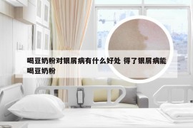 喝豆奶粉对银屑病有什么好处 得了银屑病能喝豆奶粉