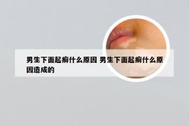 男生下面起癣什么原因 男生下面起癣什么原因造成的