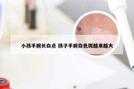 小孩手腕长白点 孩子手腕白色斑越来越大